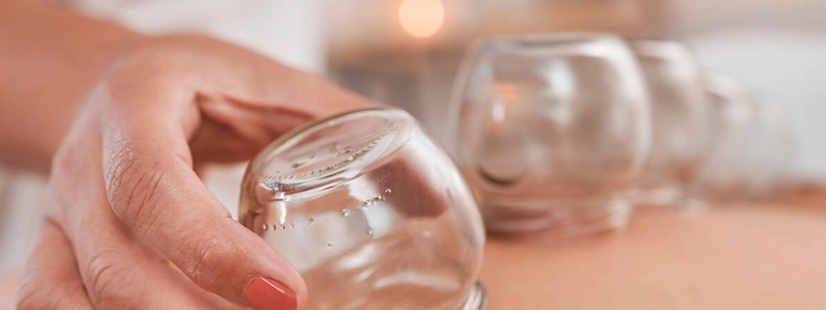 The-Beginner’s-Guide-to-Cupping-6-Things-to-Know-Before-Your-Appointment